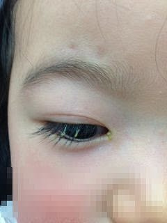 75 子供 の 目やに かわいい子供たちの画像