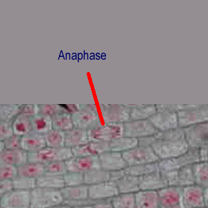 It is an optical microscope that uses light rays to produce a dark image against a bright background. Microscopy