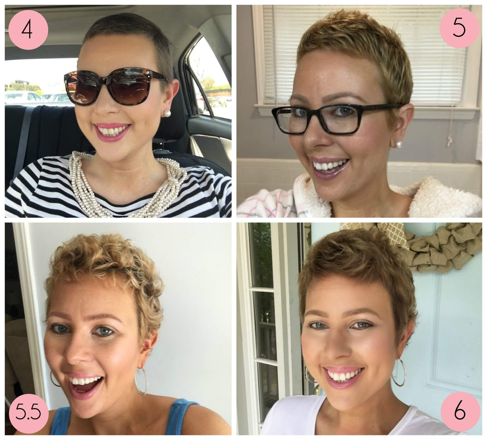 Check spelling or type a new query. Bald To Beautiful Tresses A Thriver S Hair Loss Guide Cancer Be Glammed