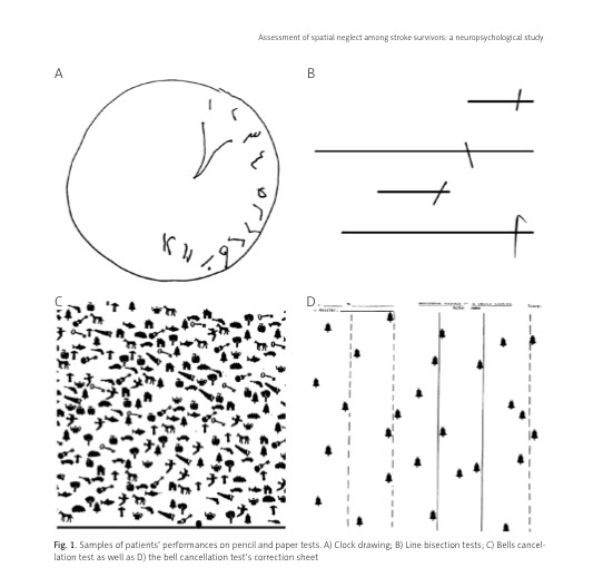 Line Bisection Test Printable / Line bisection test printable / explain with example that rate ...