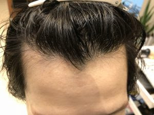現代の髪型 新鮮な富士額 男 髪型